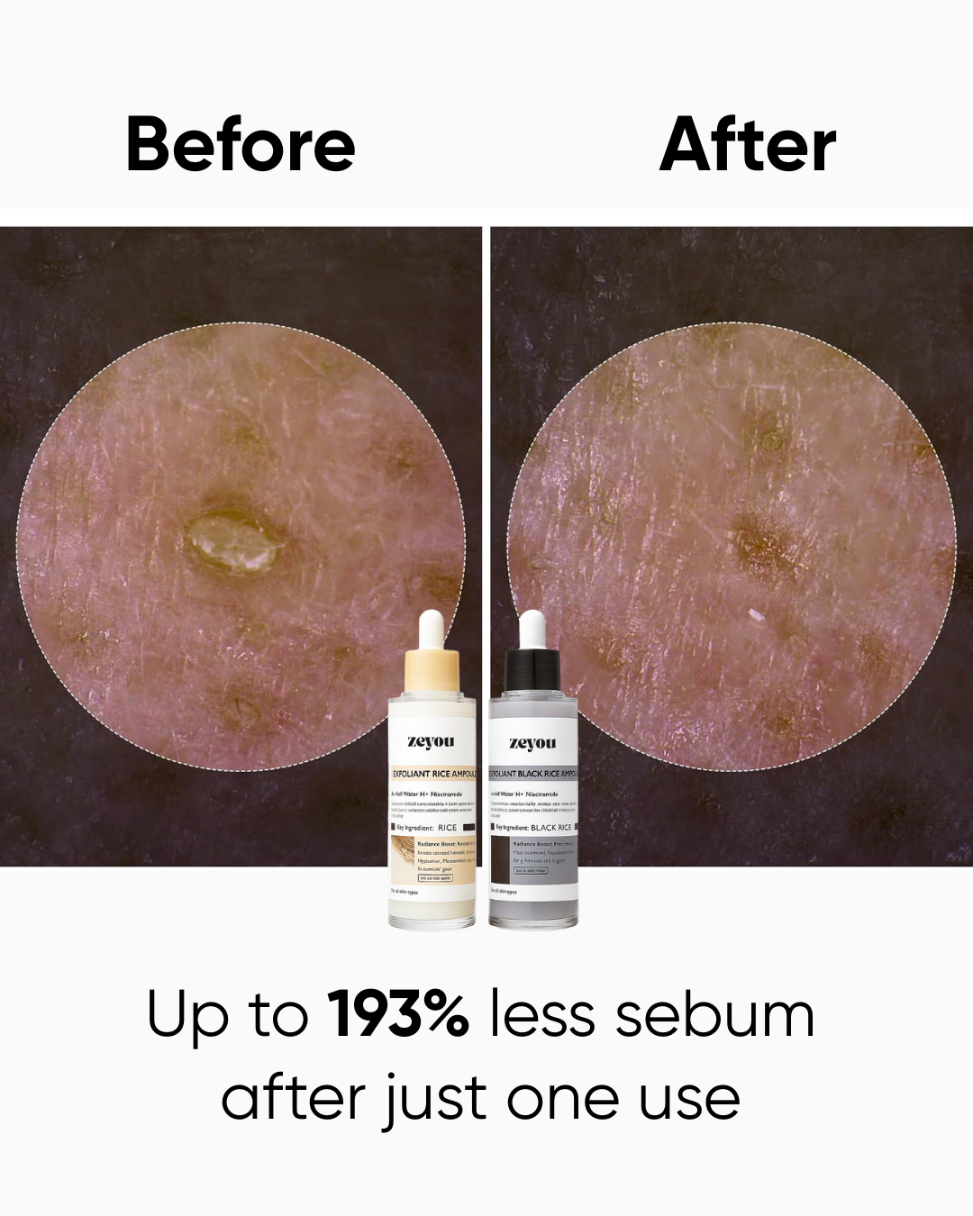 Rice Peel Shot Duo | White & Black Rice