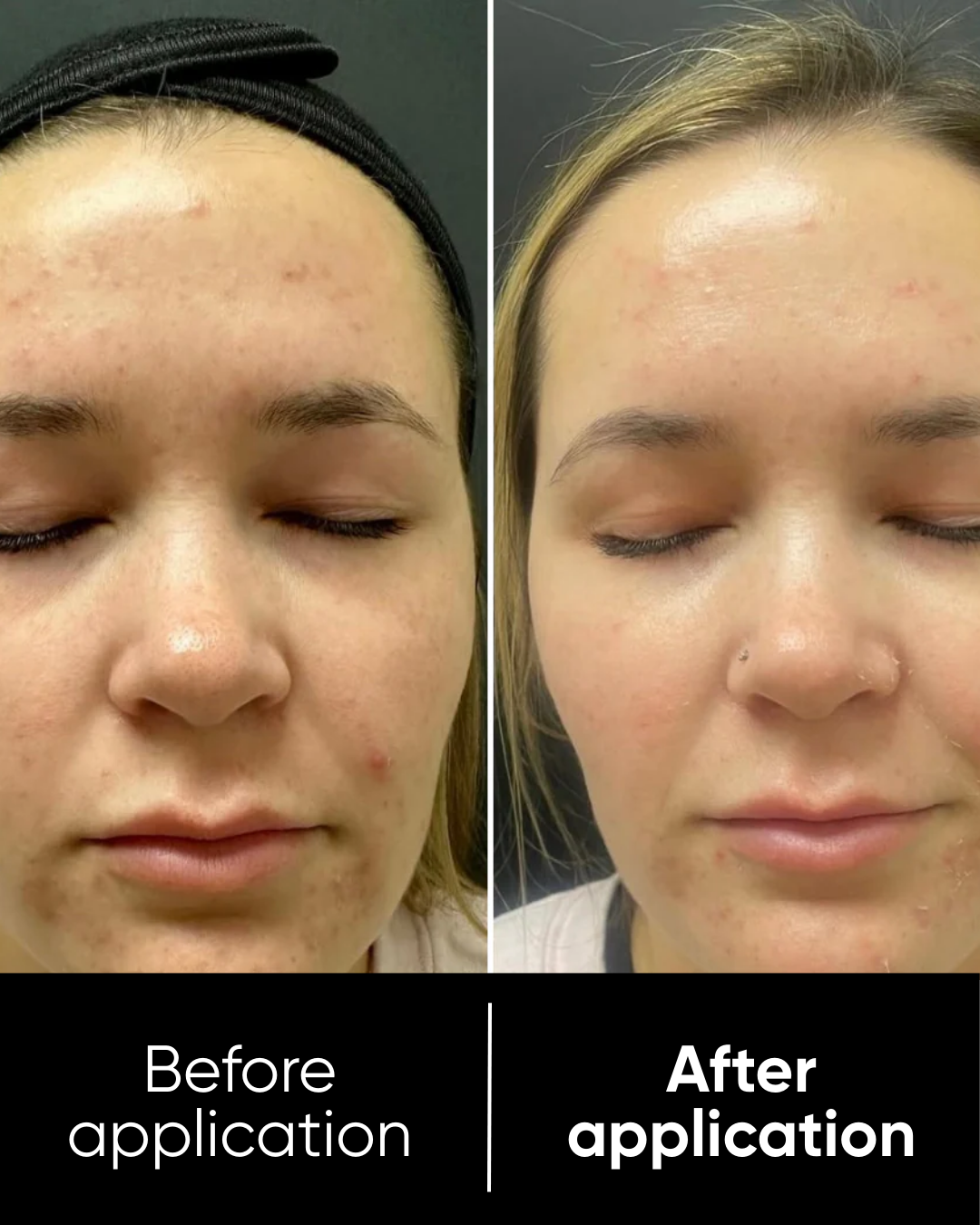 Rice Peel Shot Duo | White & Black Rice