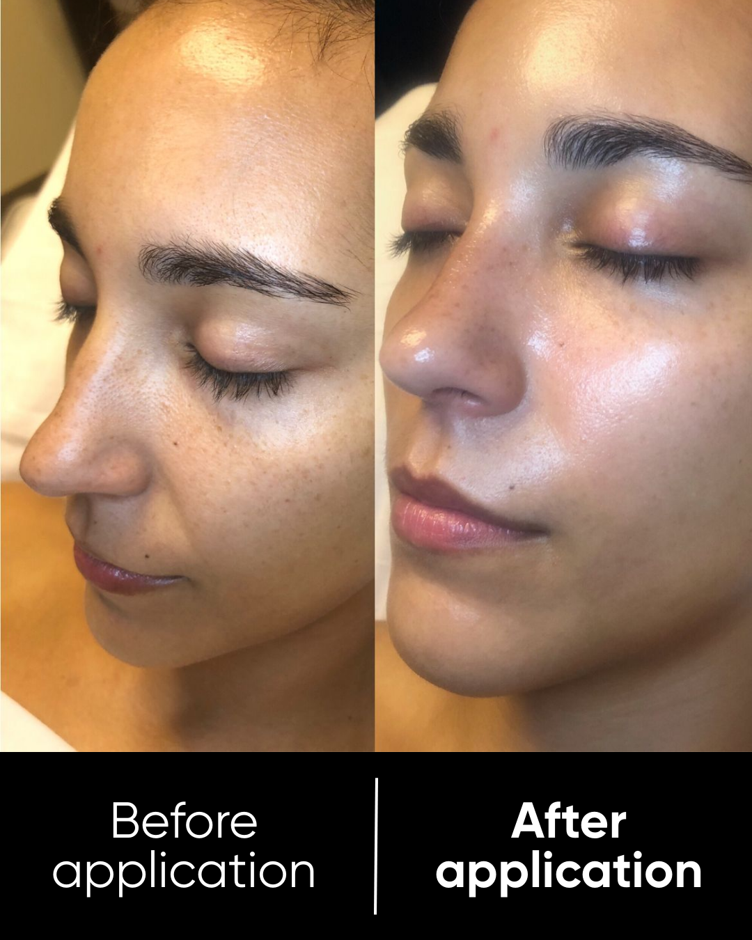 Rice Peel Shot Duo | White & Black Rice