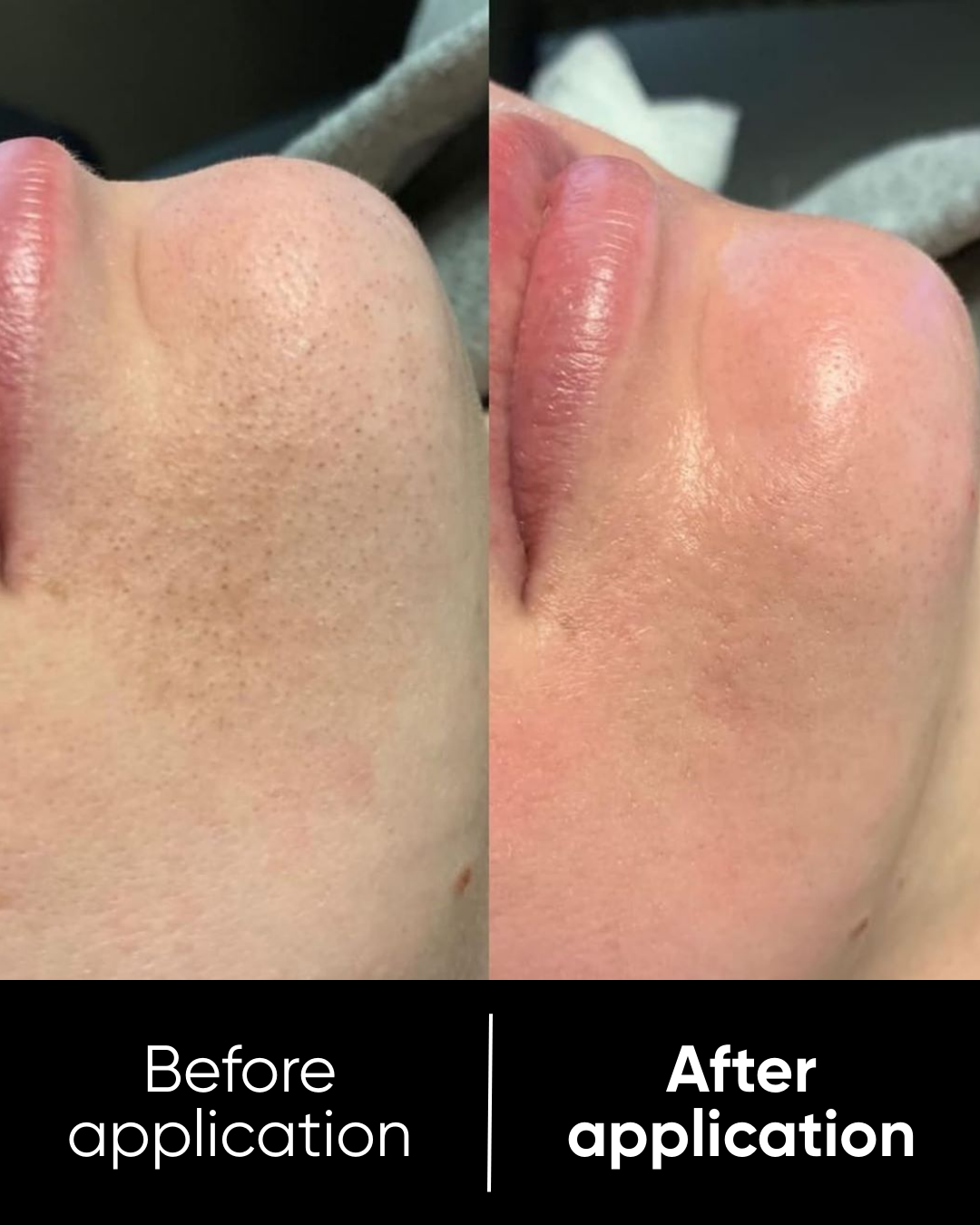 Rice Peel Shot Duo | White & Black Rice